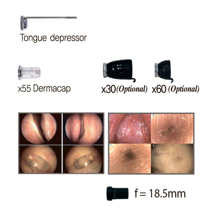 Video Otoscope Camera System